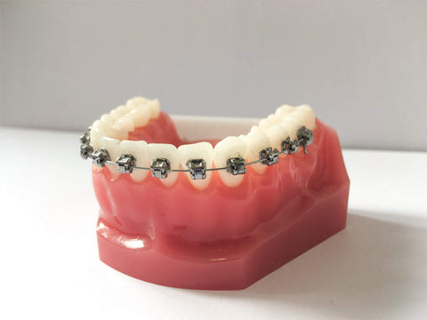 Self Ligating Braces | Manchester Orthodontics