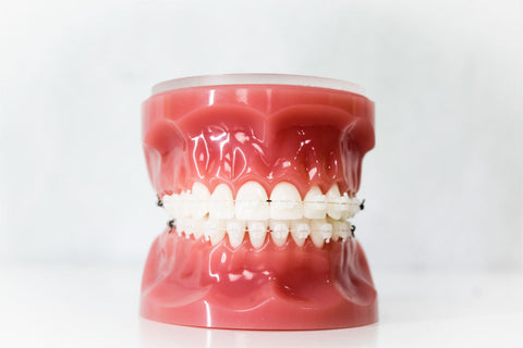 Ceramic Braces | Manchester Orthodontics